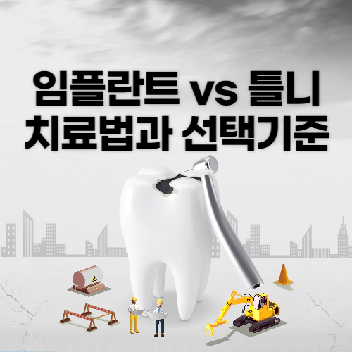 임플란트 vs 틀니, 어떤 것이 내게 맞을까 치료법과 선택 기준